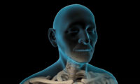 医疗医学脊椎脊柱手术3D动画
